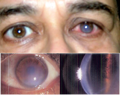 The eye & I