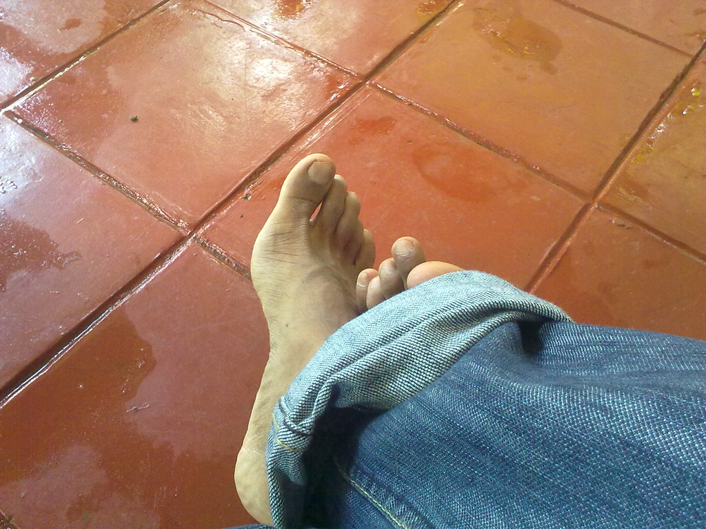 Leg